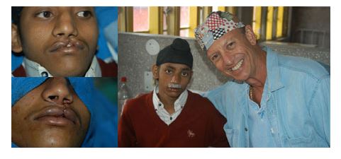 My Career In Plastic Surgery: From Beverly Hills to Africa, India, Latin America