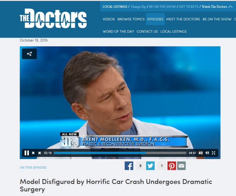 Dr. Brent Moelleken’s ABOUT FACE FOUNDATION Featured On CBS TV show “The Doctors”