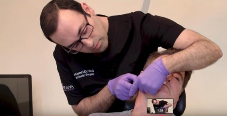 Are NovaThreads® The New Alternative To A Facelift?